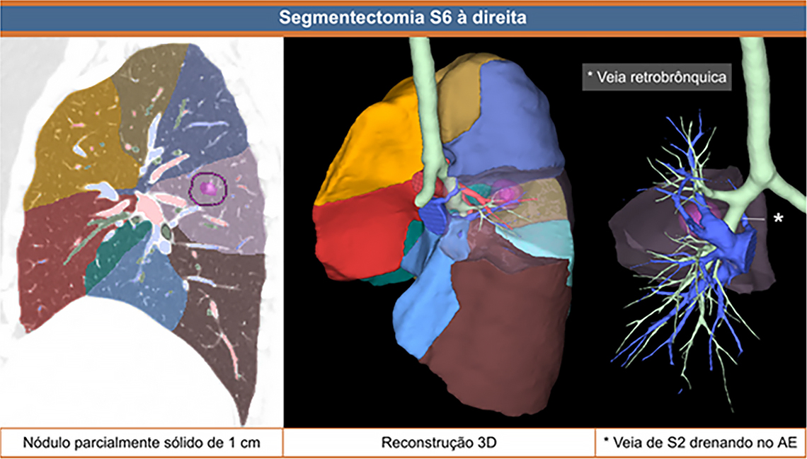 bmk-diagnostico-online-3d-caso-1 NOVO