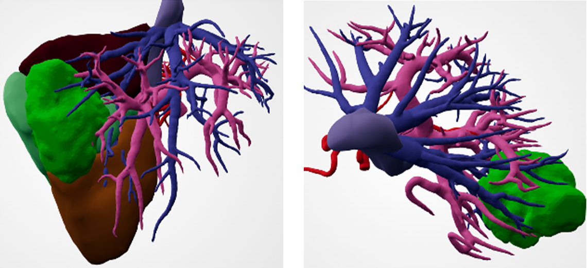 bmk-diagnostico-online-3d-caso-2 NOVO